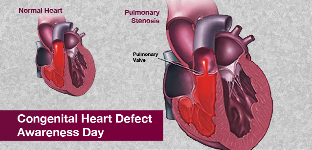 No image found 4034_Congenital_Heart_Defect_Awareness_DayE.png