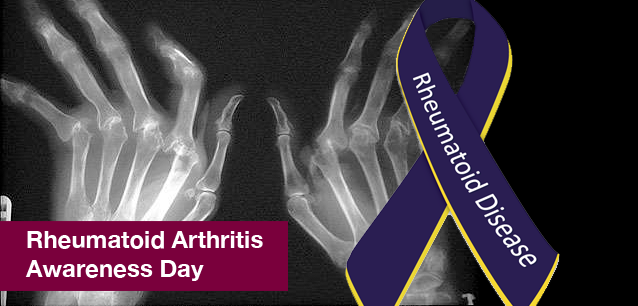 No image found 6198_Rheumatoid_Arthritis_DayE.png