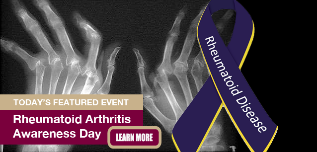 No Image found . This Image is about the event Rheumatoid Arthritis Awareness Day: February 2. Click on the event name to see the event detail.