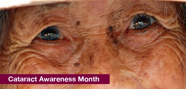 No image found 8366_Cataract_Awareness_MonthE.webp