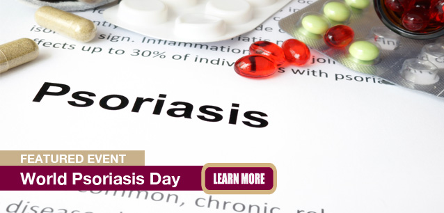 No Image found . This Image is about the event Psoriasis Day, World: October 29. Click on the event name to see the event detail.