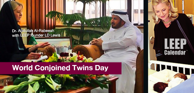 No image found World-Conjoined-Twins-Day-E.webp