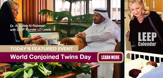 No Image found . This Image is about the event Conjoined Twins Day, World: November 24. Click on the event name to see the event detail.